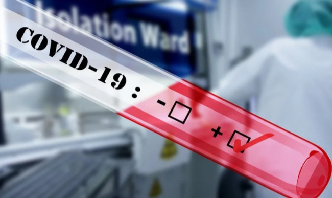 Стало відомо, скільки працівників МВС хворіє на COVID-19