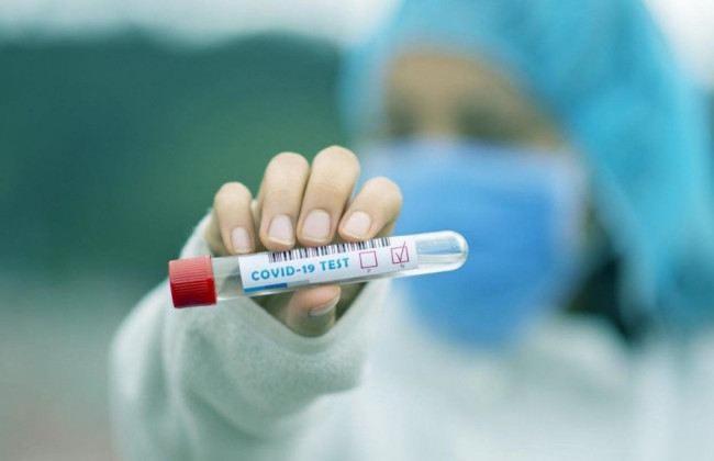 За минулу добу в Україні зафіксовано ще 2 884 випадків зараження COVID-19