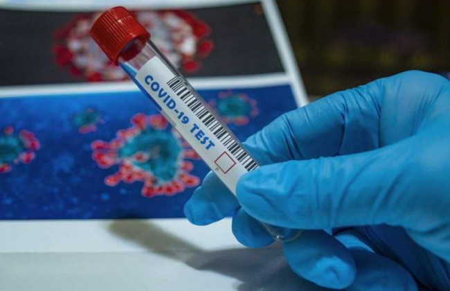 Коронавірус не відступає: в Україні 3 372 нових заражень за добу