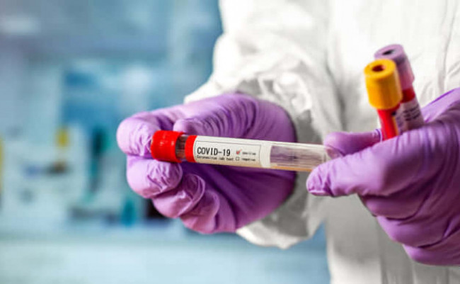 В Україні черговий антирекорд — понад 4 000 нових випадків коронавірусу