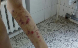 В киевском интернате избивали детей с аутизмом, фото