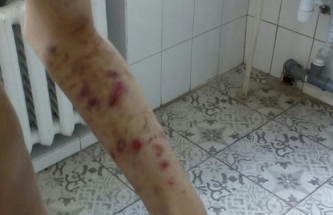 В киевском интернате избивали детей с аутизмом, фото