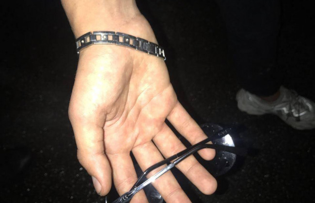 В Киеве подростки избили и ограбили мужчину: фото