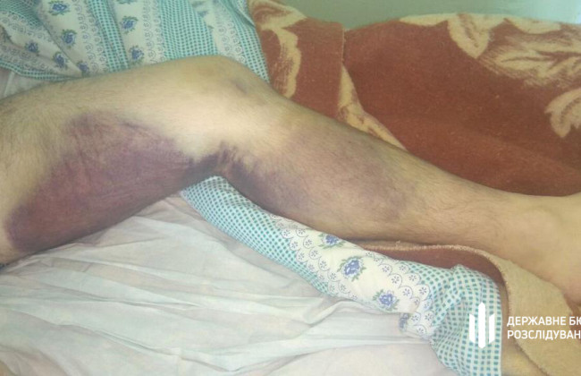 6 копів з Миколаєва підозрюються у катуванні: за справу взялося ДБР, фото