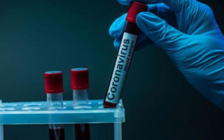 Как и когда Украина получит вакцину от COVID-19: в Минздраве раскрыли детали