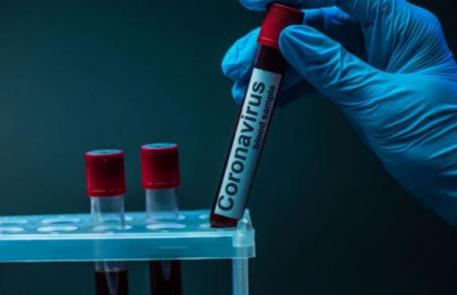 Как и когда Украина получит вакцину от COVID-19: в Минздраве раскрыли детали