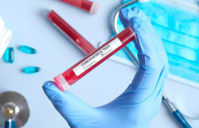 В Украине могут сократить сроки осуществления тестирования на COVID-19