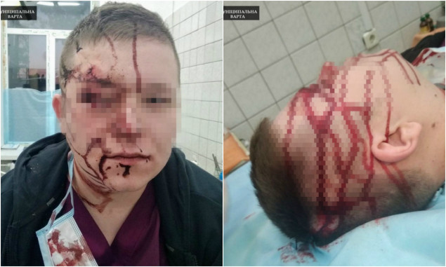 Не понравились стены в больнице: в Киеве недовольный пациент избил врача стулом, фото