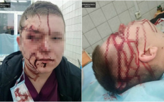 Не понравились стены в больнице: в Киеве недовольный пациент избил врача стулом, фото