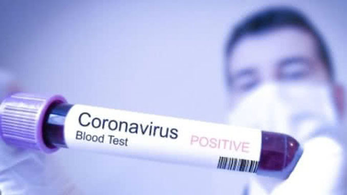 Ще понад 600 киян захворіли на коронавірус: де найбільше випадків