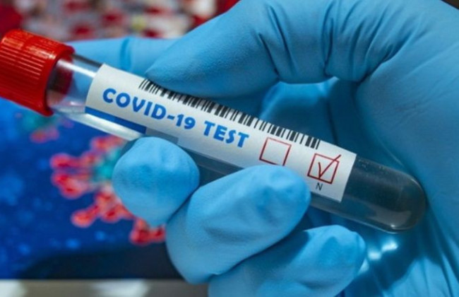 Черговий антирекорд: у МОЗ повідомили кількість інфікованих COVID-19