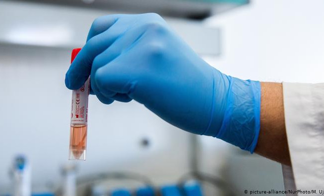 МОЗ: українська вакцина від COVID-19 може з'явитися вже через рік