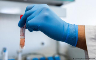 МОЗ: українська вакцина від COVID-19 може з'явитися вже через рік