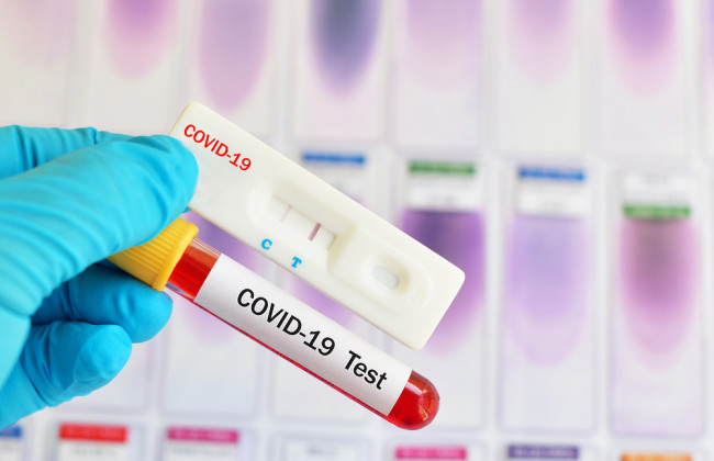 В Украине зафиксировали 6 677 новых случаев коронавируса