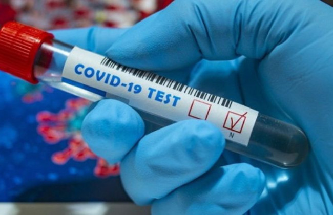 Понад 7 300 нових випадків: у МОЗ повідомили кількість інфікованих COVID-19