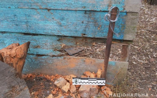 На Харківщині 9-річній дитині відірвало кисть: хлопчик постраждав від вибуху