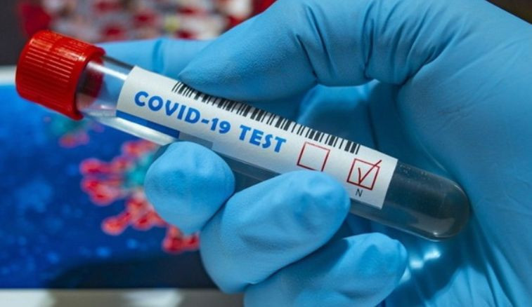Черговий антирекорд: у МОЗ повідомили кількість інфікованих COVID-19