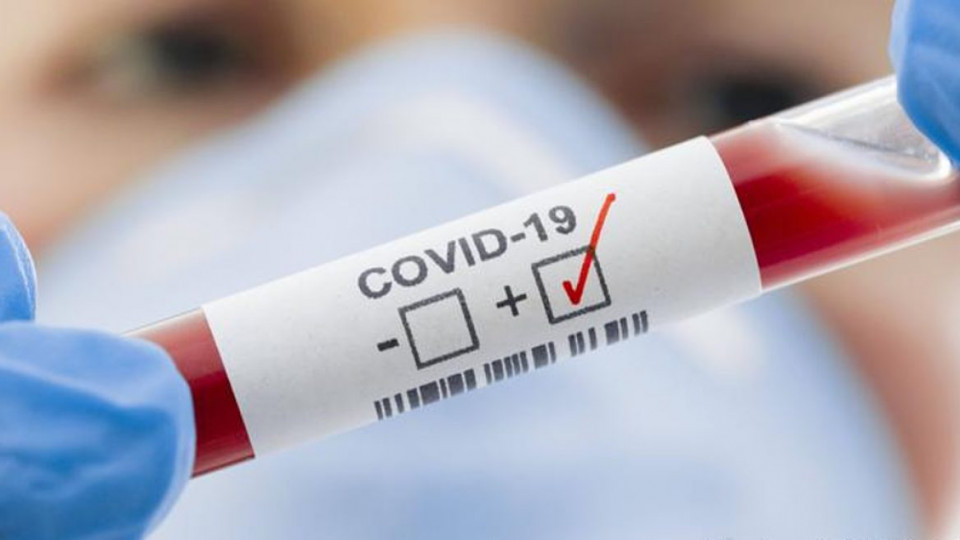 Новые случаи: коронавирус в Украине обнаружили у 6754 человек