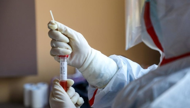 У МОЗ заявили, що всіх українців, які хворі на пневмонію, тестують на коронавірус