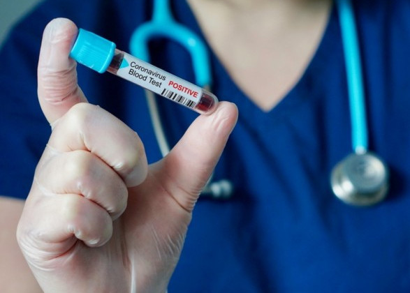 Коронавирусный рекорд: почти 8900 подтвержденных случаев за сутки