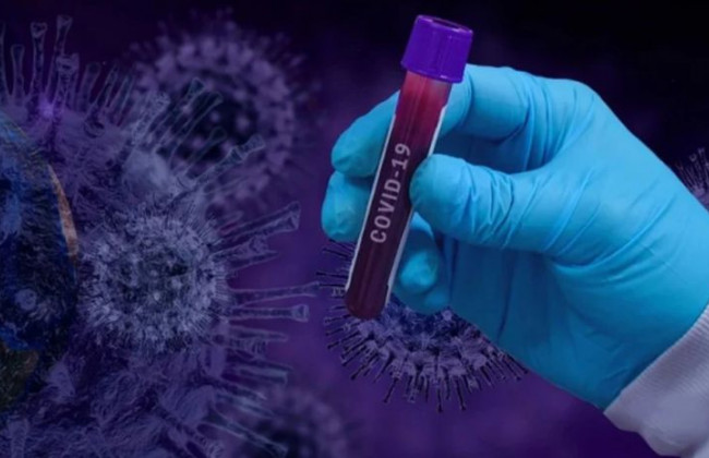 Черговий антирекорд: коронавірус продовжує лютувати в Україні