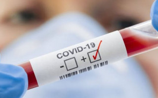 COVID-статистика: в Украине обнаружили 11 968 новых случаев коронавируса