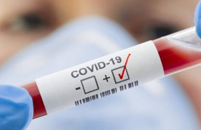 COVID-статистика: в Украине обнаружили 11 968 новых случаев коронавируса