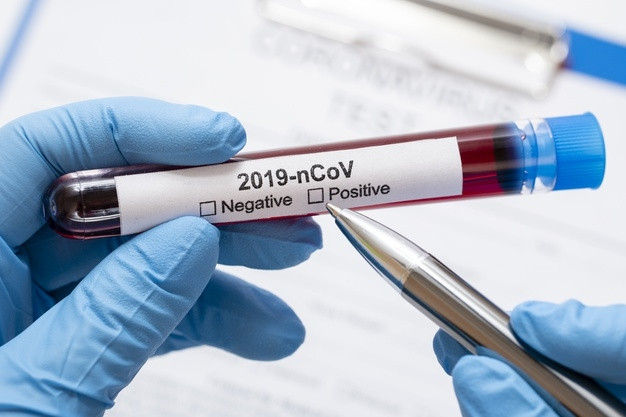 Україна закупить 6 мільйонів експрес-тестів на коронавірус, — Шмигаль