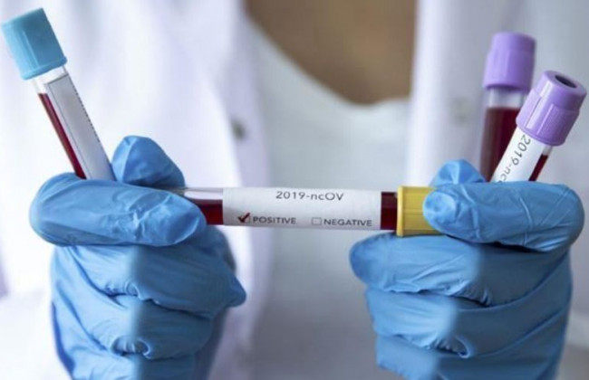 Как долго может сохраняться иммунитет к коронавирусу: ученые дали ответ