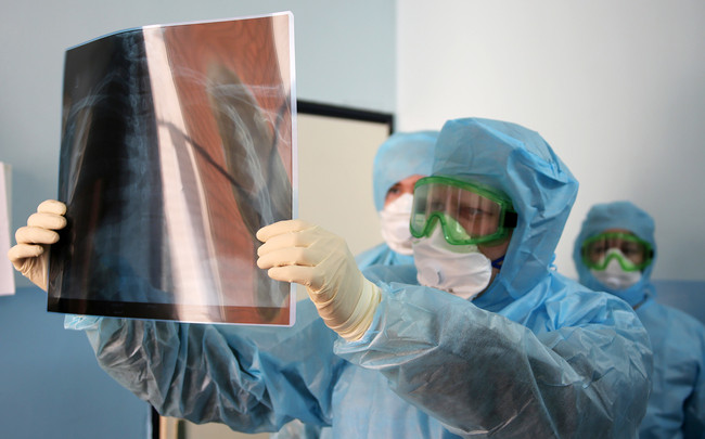 Коронавирус поражает головной мозг: ученые выяснили, что болезнь попадает через нос