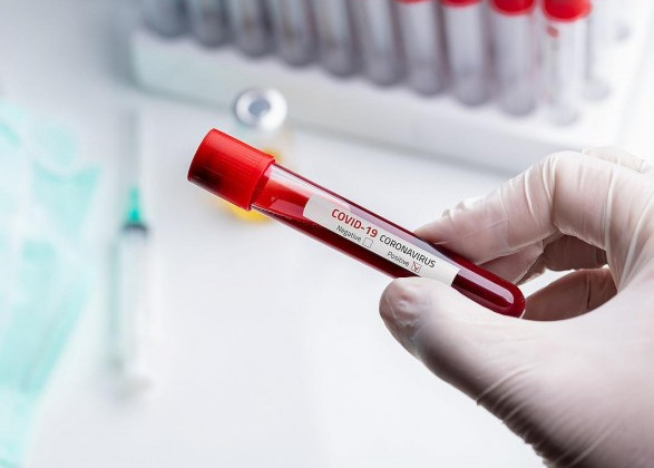 В Украине 13 825 новых случаев COVID-19