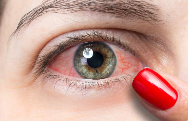 Стал известен еще один ранний симптом COVID-19: как выявить болезнь