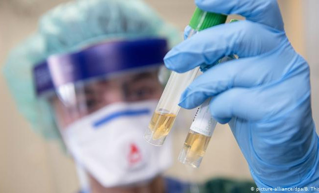 В США нашли новый опасный симптом COVID-19