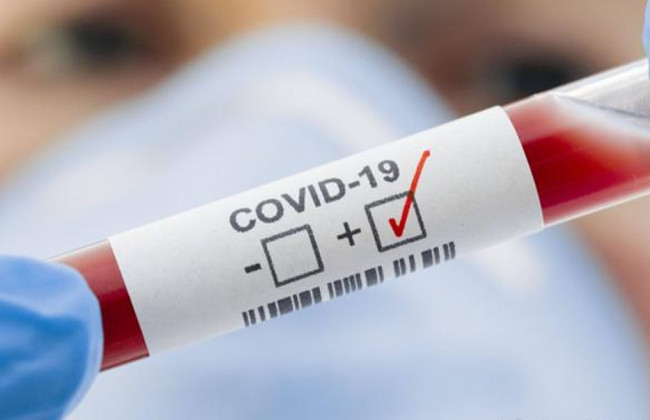 В Украине обнаружен случай заражения новым штаммом коронавируса