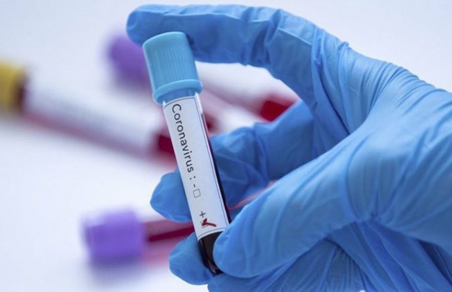 Коронавирус в Украине обнаружили у 9432 человек