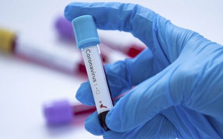 Коронавирус в Украине обнаружили у 9432 человек