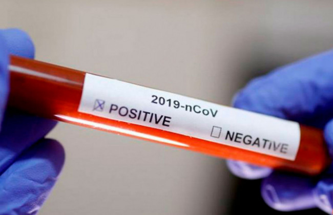 В Украине вновь снизилось количество подтвержденных случаев COVID-19