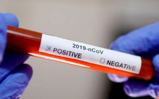 В Украине вновь снизилось количество подтвержденных случаев COVID-19