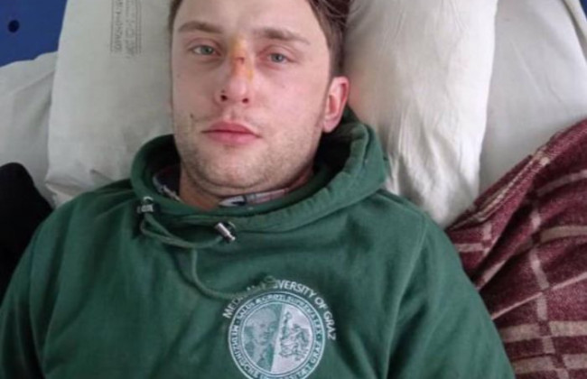 После ДТП пропала память: в Киеве ищут родственников парня, фото