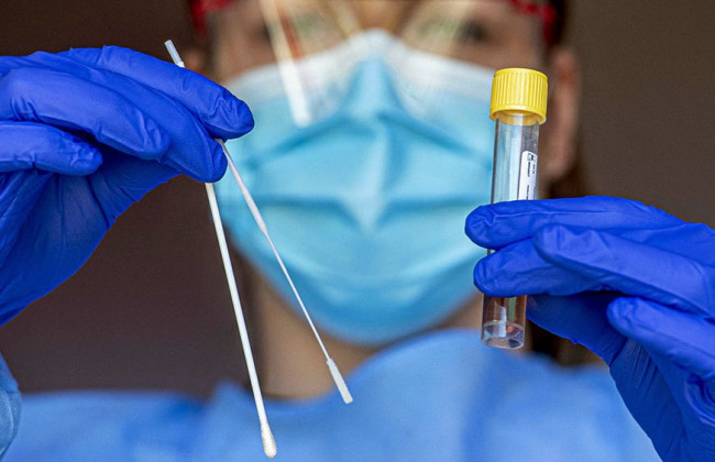 За последние сутки в Украине выявлено 4 383 новых случая коронавируса