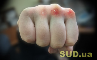 На Хмельниччині мати до смерті побила чотирирічну доньку