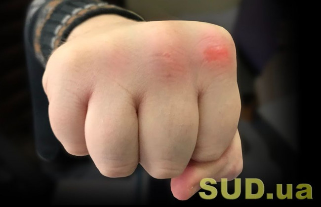 В Киеве неадекватный пешеход напал на водителя, видео