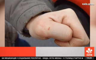 У Києві біля станції метро «Політехнічний інститут» продавець шаурми покусав оператора телеканалу «Київ»