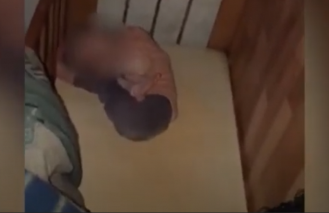 Важить 9 кілограмів у 15 років: у Кривому Розі горе-мати морила голодом власну доньку, фото і відео