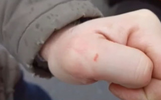 Столичний «шеф-кухар» покусав знімальну групу телеканалу, відео