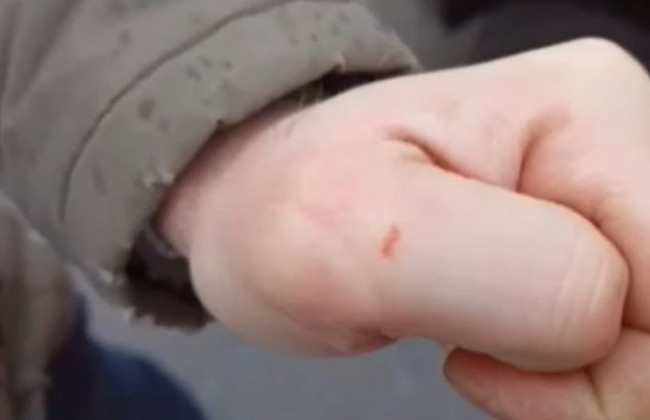 Столичний «шеф-кухар» покусав знімальну групу телеканалу, відео