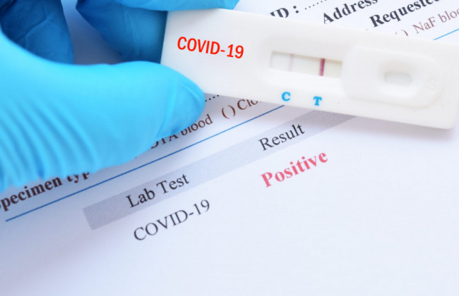 У летучих мышей в Таиланде обнаружили новый коронавирус