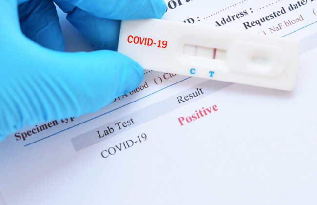 Какие есть виды тестов на коронавирус и чем они отличаются: разъяснение Минздрава