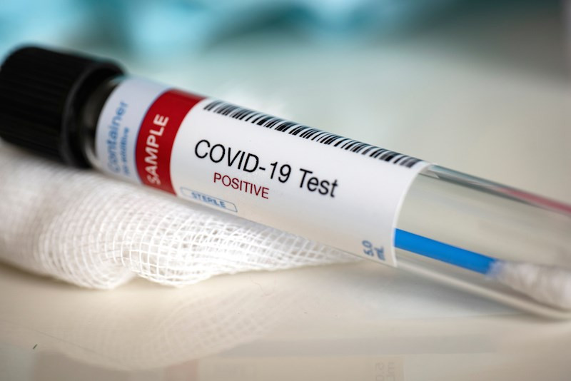 В Украине фиксируют более 8 тысяч новых случаев коронавируса