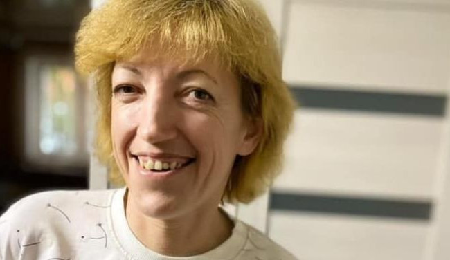 В Киеве пропала женщина со шрамом возле левого глаза, фото